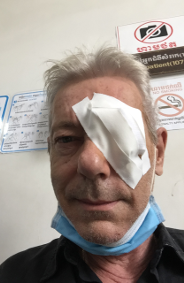 Eye surgery Thierry Poupard